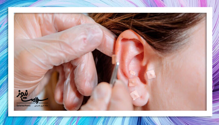 طب سوزنی بلای جانتان میشود اگر.. طب سوزنی بلای جانتان میشود اگر..