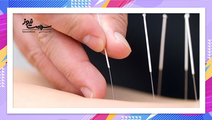 طب سوزنی؛ راهی نو برای تسکین کمردرد مزمن سالمندان طب سوزنی؛ راهی نو برای تسکین کمردرد مزمن سالمندان