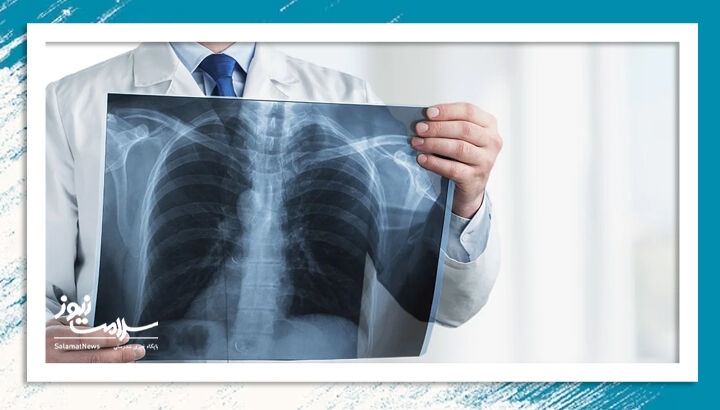 علائم، علل و روشهای درمان برونشیت حاد و مزمن  علائم، علل و روشهای درمان برونشیت حاد و مزمن