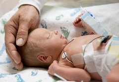 عوارض کم‌کاری تیروئید در نوزادان چیست؟