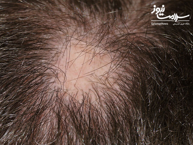 عوارض پوستی