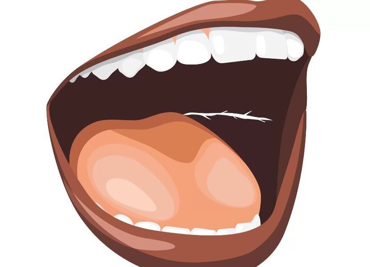 چه چیزی باعث ایجاد خط سفید داخل گونه ها می شود؟ (+عکس) چه چیزی باعث ایجاد خط سفید داخل گونه ها می شود؟ (+عکس)