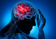 علائم سکته مغزی چیست؟