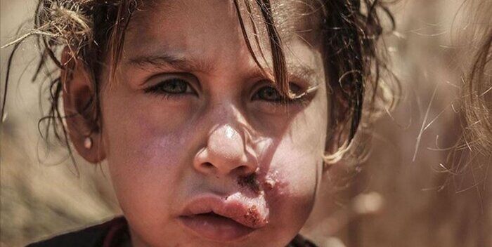 سالک کشنده نیست/ضرورت استفاده از مواد دور کننده حشرات در مناطق روستایی