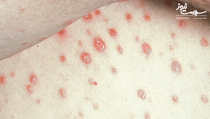 رابطه جنسی دهانی چیست و چه خطراتی دارد؟