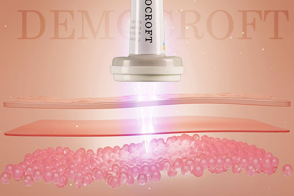 دموکرافت با 3 تکنولوژی در کوتاهمدت آکنهها را محو میکند