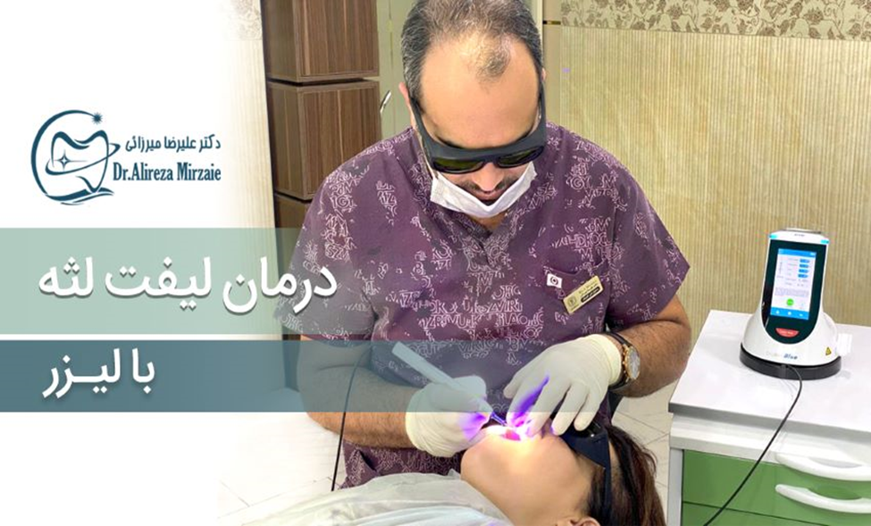 کاربردهای لیزر ، لیفت لثه دکتر علیرضا میرزایی