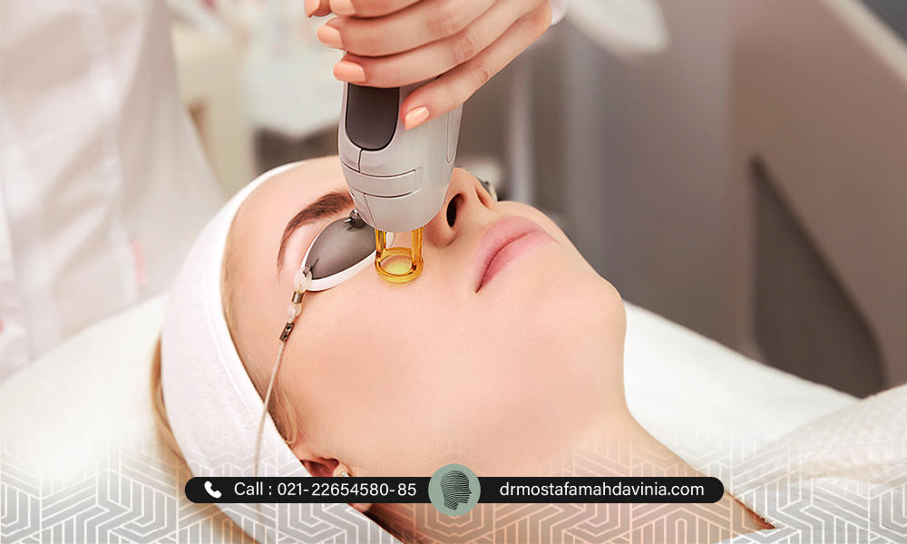 آیا لیزر موهای زائد صورت درد دارد ؟