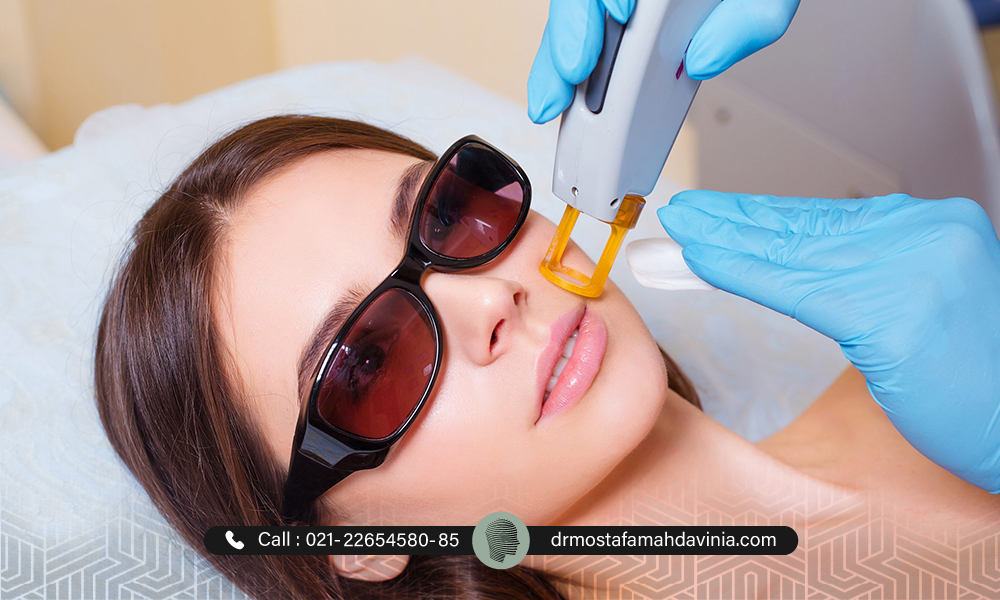 آیا لیزر موهای زائد صورت درد دارد ؟
