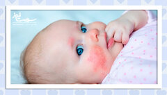 آلرژی های پوستی نوزادان به چه شکل ظاهر می شوند؟
