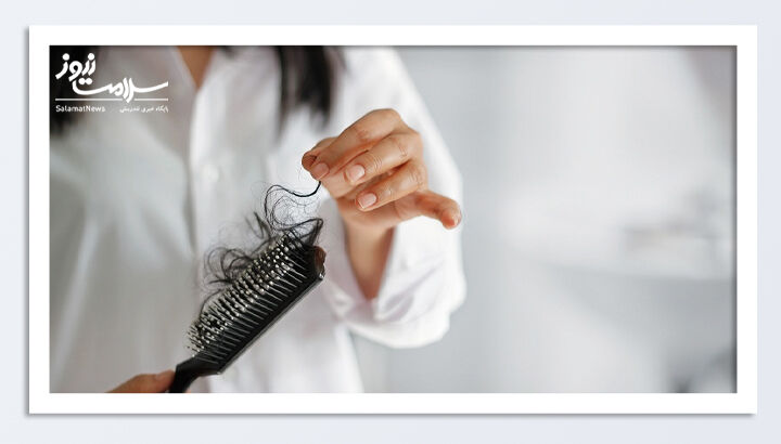 آیا ریزش مو نشانه ابتلا به بیماری خاصی است؟