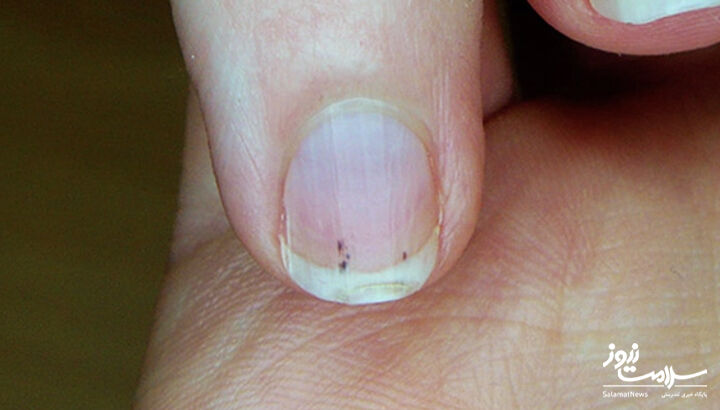 12 سرنخ که نشان می دهد بیماری قلبی دارید