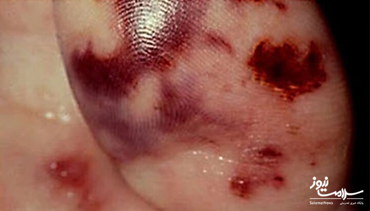 تغییر رنگ پوست