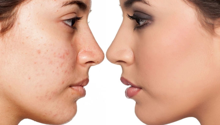 کانابیدیول یا CBD چیست؟