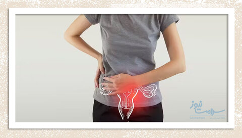 شناسایی مولکول F2R؛ امیدی تازه برای درمان سرطان تخمدان