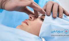 مشاوره جراحی زیبایی بینی در تهران