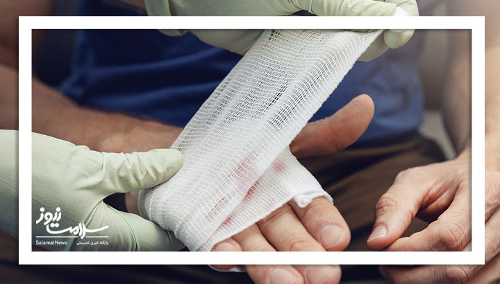 6 درمان خانگی برای توقف سریع خونریزی 6 درمان خانگی برای توقف سریع خونریزی