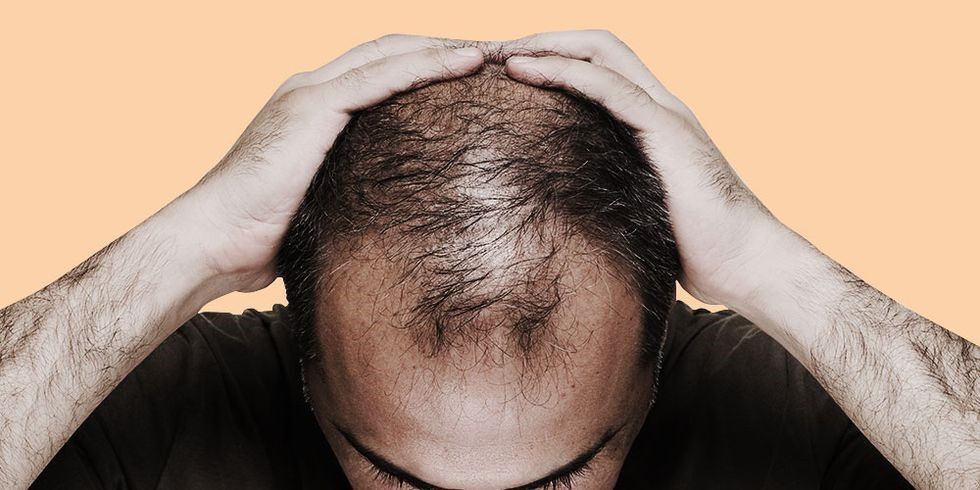 ۶ ریزمغذی موثر در جلوگیری از ریزش مو | 1000tar.ir