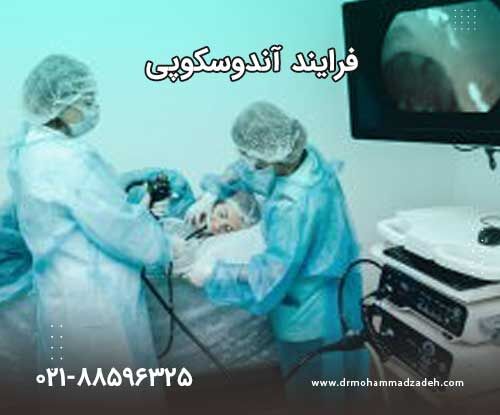 آندوسکوپی چیست و چگونه انجام می شود؟ مراحل آندوسکوپی معده با بیهوشی
