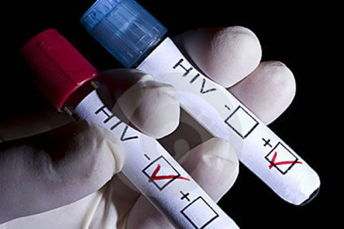 هنوز سیاست گذاران اجتماعی واقعیت بیماری ایدز را نپذیرفته اند