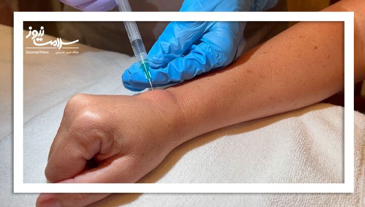 آسپیراسیون