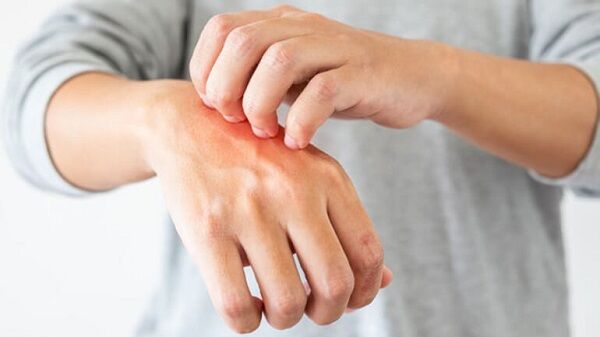 سلیاک؛ بیماری هزار چهره سلیاک؛ بیماری هزار چهره