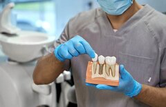 ایمپلنت دندان را نزد چه متخصصی انجام دهیم؟