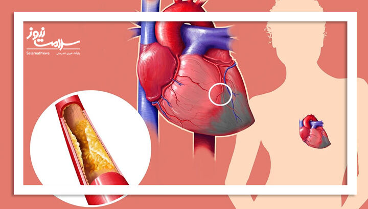 روشهای طبیعی و سالم برای کاهش کلسترول بد روشهای طبیعی و سالم برای کاهش کلسترول بد