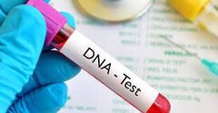 ایران جزو چند کشور سازنده کیت تشخیص DNA است