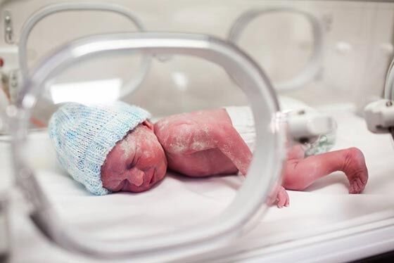 شیوع نقایص مادرزادی در نوزادان متولد از مادران مبتلا به سرطان