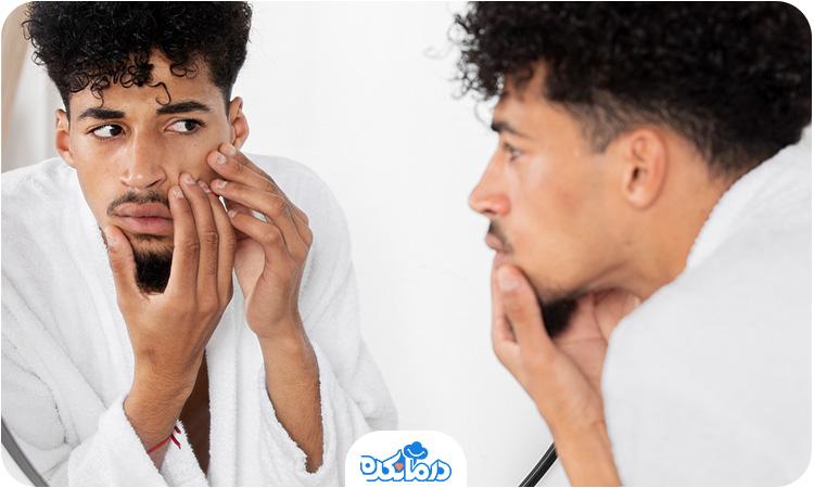 جوش ناگهانی صورت به چه علت رخ میدهد؟