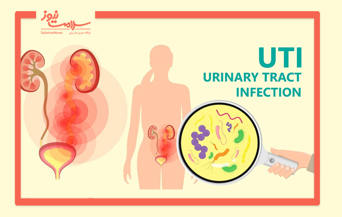 روشی برای درمان عفونت های ادراریِ مکرر بدون آنتی بیوتیک  روشی برای درمان عفونت های ادراریِ مکرر بدون آنتی بیوتیک