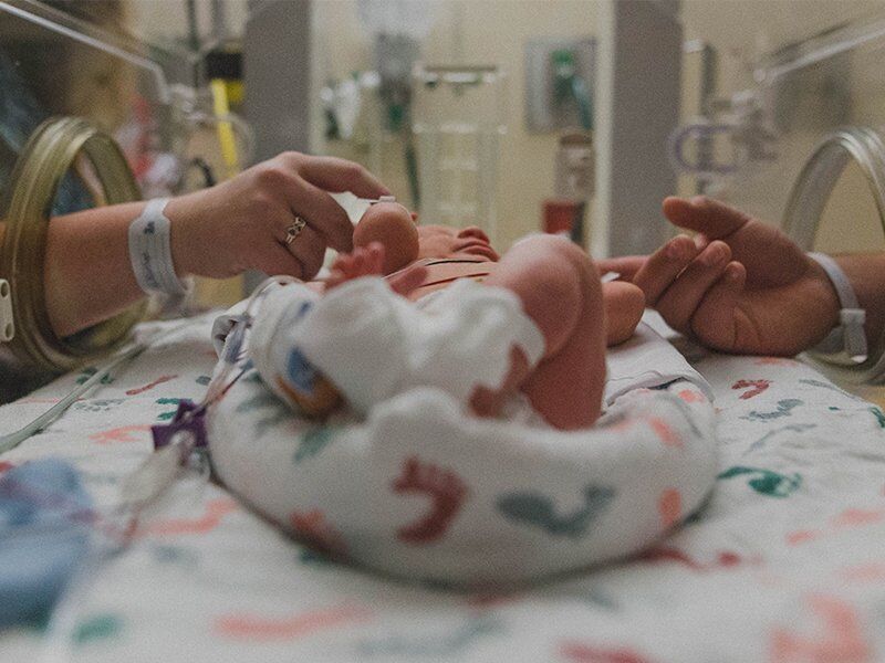 چه نوزادانی نیاز به NICU دارند؟ (بخش مراقبت های ویژه نوزادان ) چه نوزادانی نیاز به NICU دارند؟ (بخش مراقبت های ویژه نوزادان )