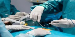 راهنمایی جامع در مورد جراحی اسلیو معده با بیمه تکمیلی