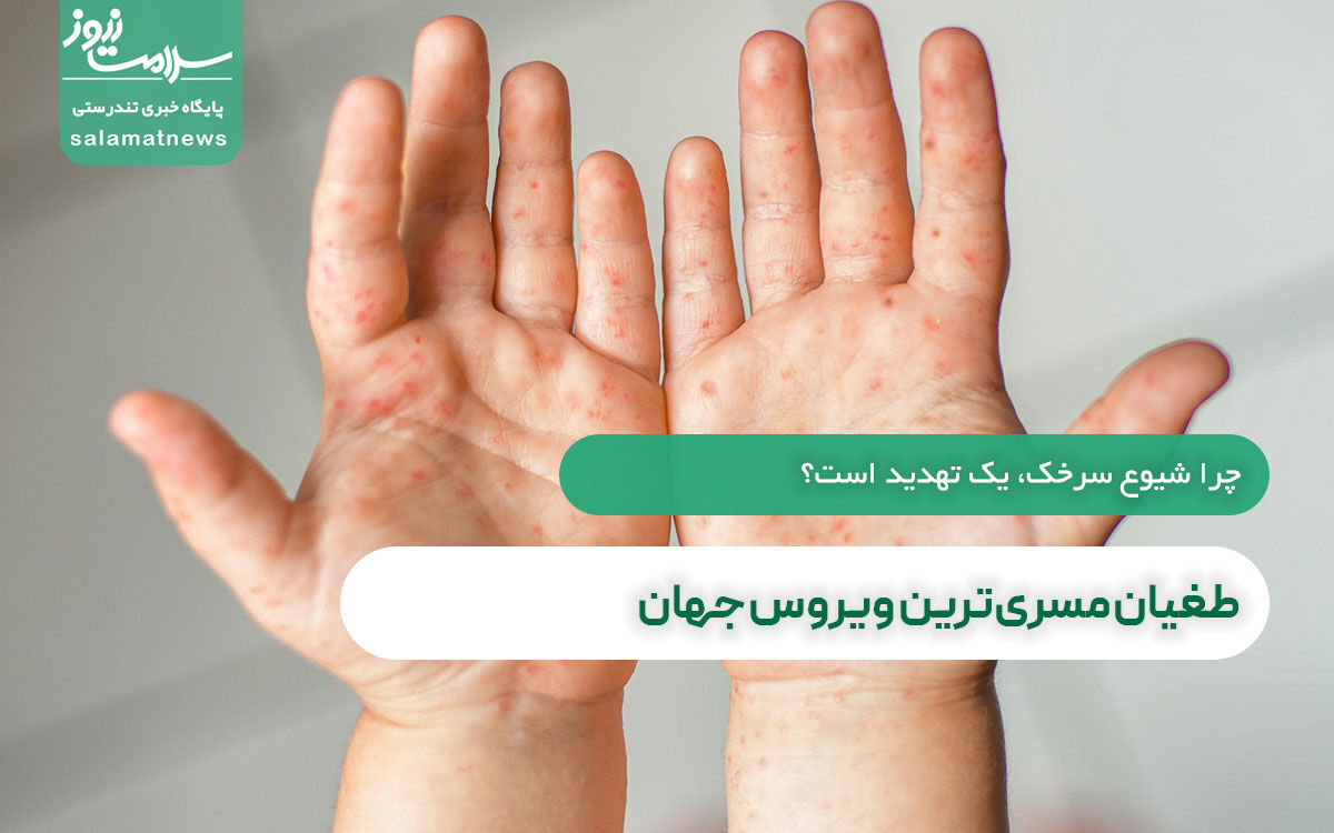 طغیان مسریترین ویروس جهان  طغیان مسریترین ویروس جهان