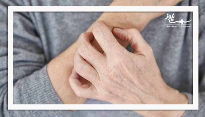 درمان خشکی پوست با کمک طب سنتی درمان خشکی پوست با کمک طب سنتی