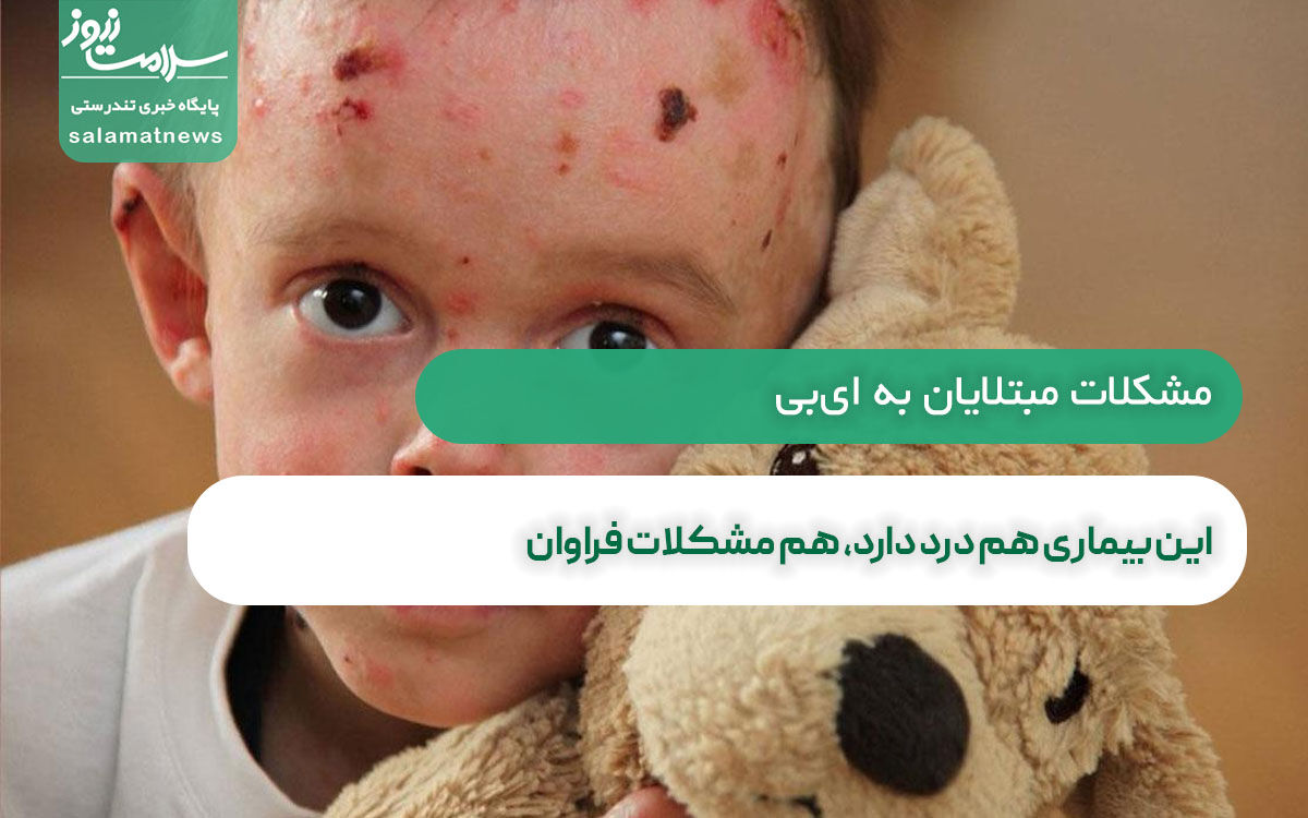 این بیماری هم درد دارد، هم مشکلات فراوان این بیماری هم درد دارد، هم مشکلات فراوان