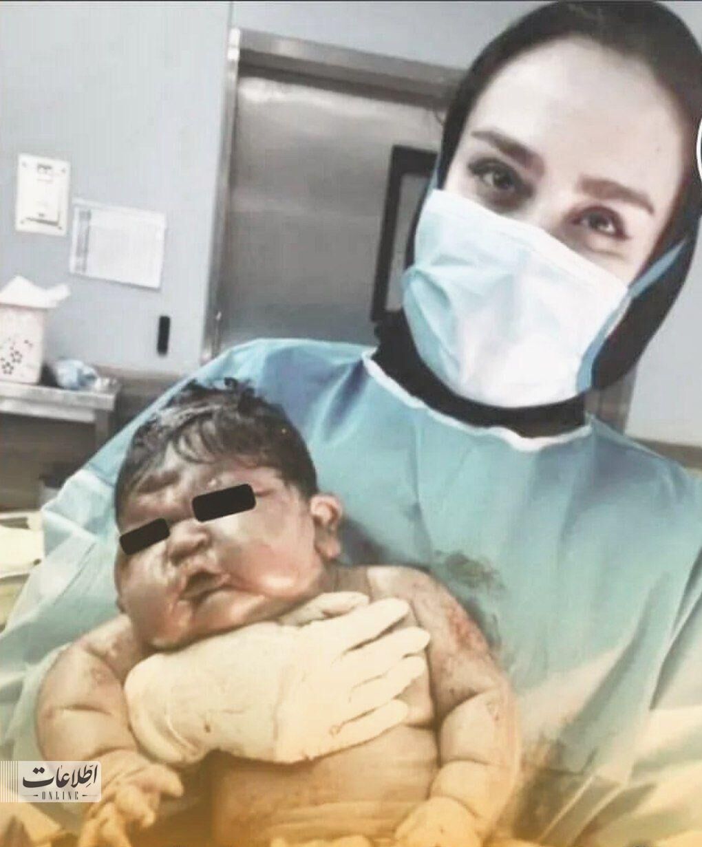 عکس/نوزاد مشهدی سنگین وزن ترین نوزاد ایران!