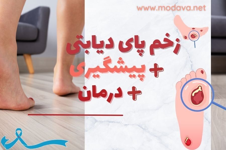 زخم پای دیابتی + نکات کاربردی برای پیشگیری در منزل