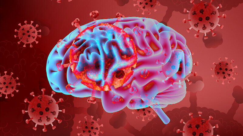 اسکن‌ها تغییرات مغزی در مبتلایان کووید طولانی را نشان می‌دهند