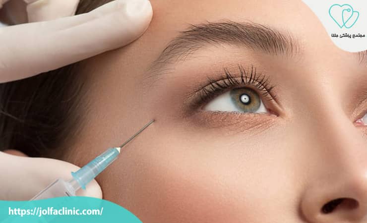 جوانسازی صورت با تزریق ژل و بوتاکس زیر نظر متخصص در کلینیک زیبایی جلفا