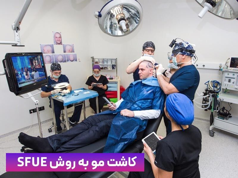 آیا کاشت مو به روش SUPER FUE جدیدترین روش کاشت مو است ؟ آیا کاشت مو به روش SUPER FUE جدیدترین روش کاشت مو است ؟