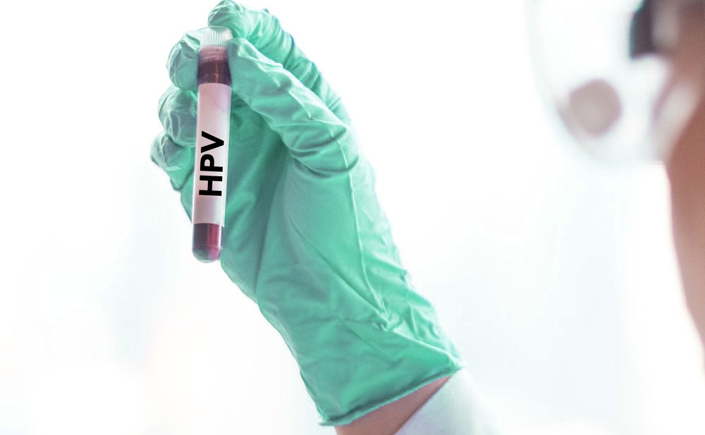 تست های تشخیص بیماری های مقاربتی (جنسی)