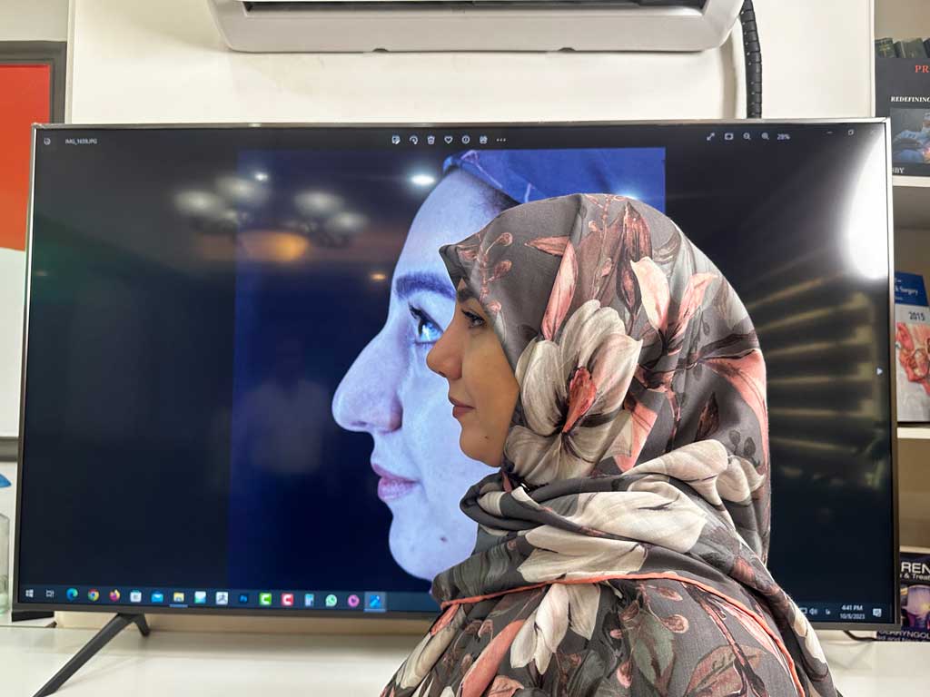 هر آنچه که باید در مورد عمل بینی استخوانی بدانید