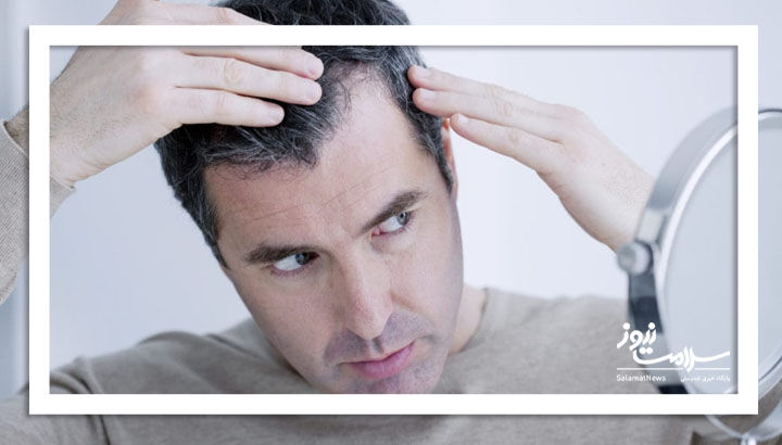 راز موهای سالم با طب ایرانی؛ درمانی طبیعی، ارزان و مؤثر راز موهای سالم با طب ایرانی؛ درمانی طبیعی، ارزان و مؤثر