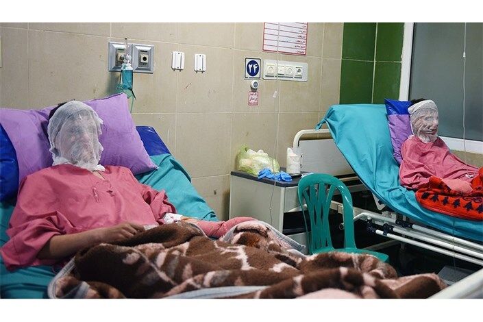 چهارشنبه آخر سال و هشدار درباره خطرات سوختگی چهارشنبه آخر سال و هشدار درباره خطرات سوختگی