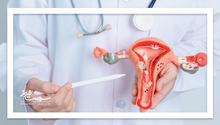 کاهش درد آندومتریوز با حذف برخی مواد غذایی رایج کاهش درد آندومتریوز با حذف برخی مواد غذایی رایج