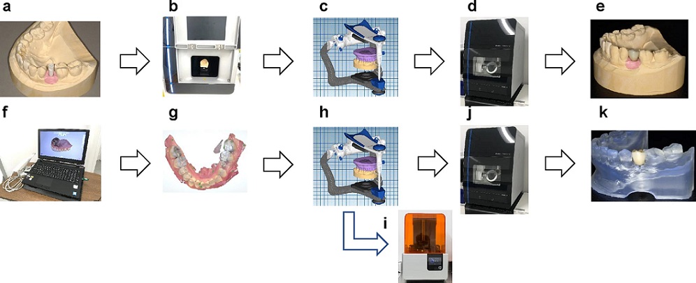 تفاوت ایمپلنت دندان دیجیتال و معمولی چیست؟