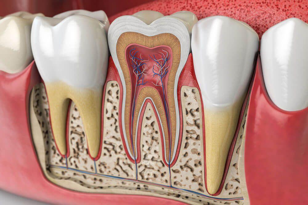 عصب‌کشی: راهکار ایده‌آل برای رهایی از درد و حفاظت دندان‌ها