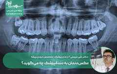 عکس دندان به دندانپزشک چه می‌گوید؟